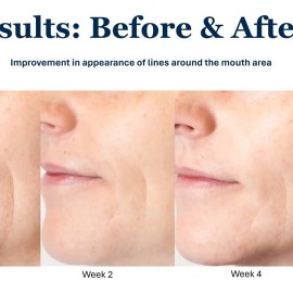 TrueScience Activated Skin Care 8 Week Study Results